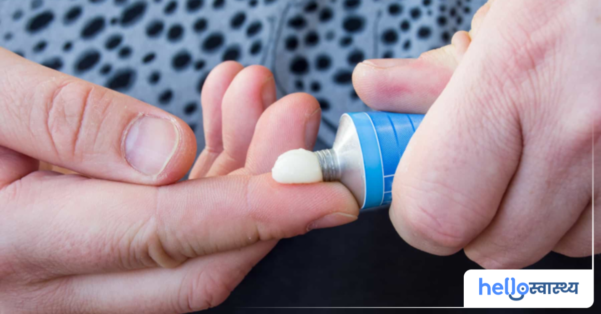 Smuth Ointment : स्मूथ ऑइंटमेंट क्या है? जानिए इसके उपयोग और साइड ...