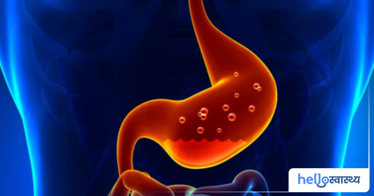 GERD Ayurvedic remedies GERD का आयुर्वेदिक उपचार क्या है? हैलो स्वास्थ्य