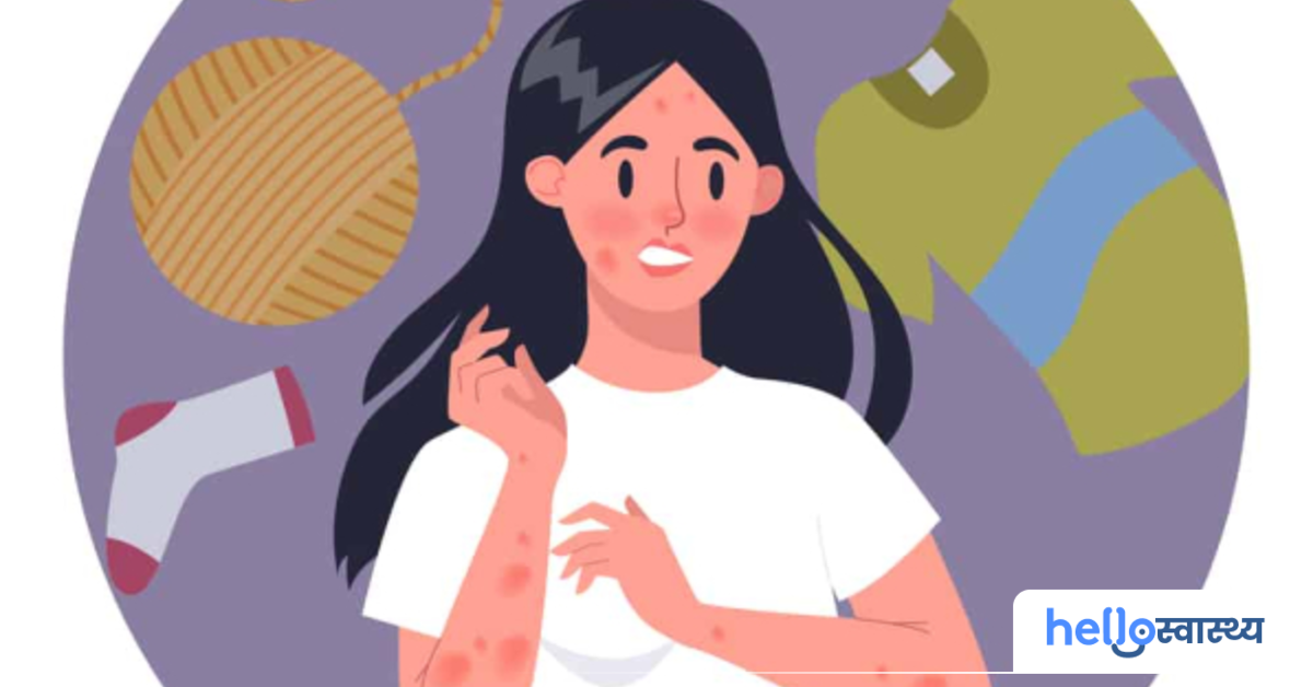 पॉलिएस्टर एलर्जी (Polyester Allergy) के बारे में जानें विस्तार से